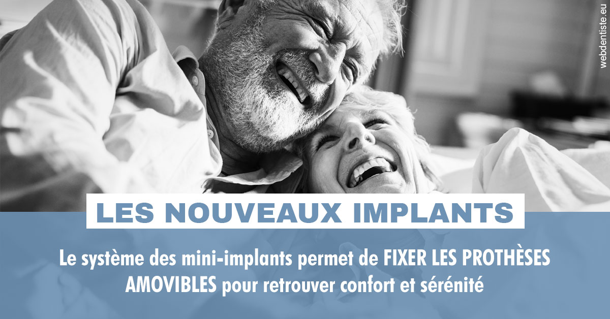 https://dr-marie-jose-huguenin.chirurgiens-dentistes.fr/Les nouveaux implants 2
