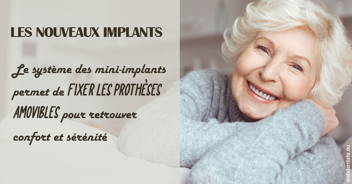 https://dr-marie-jose-huguenin.chirurgiens-dentistes.fr/Les nouveaux implants 1