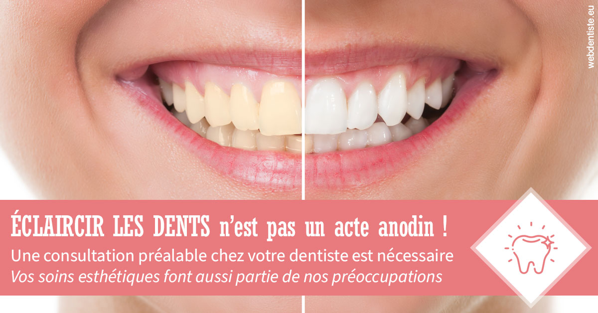https://dr-marie-jose-huguenin.chirurgiens-dentistes.fr/Eclaircir les dents 1