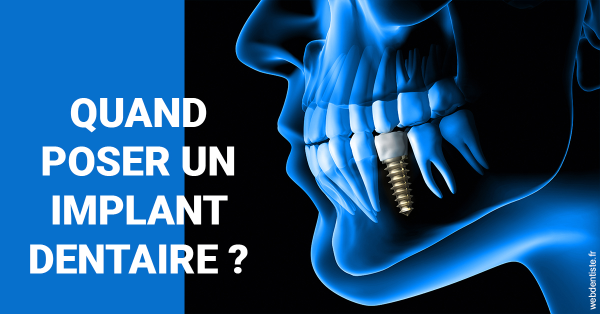 https://dr-marie-jose-huguenin.chirurgiens-dentistes.fr/Les implants 1