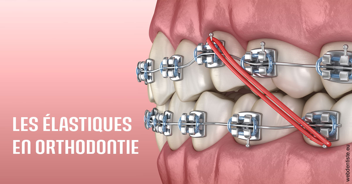 https://dr-marie-jose-huguenin.chirurgiens-dentistes.fr/Elastiques orthodontie 2