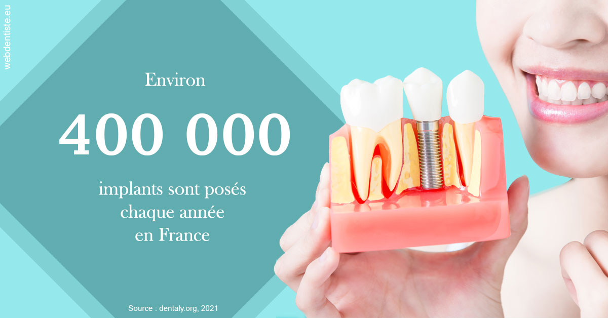 https://dr-marie-jose-huguenin.chirurgiens-dentistes.fr/Pose d'implants en France 2